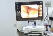 Hospital de Regional de Gurupi recebe novo aparelho de endoscopia