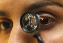 Por Niceia Menegon – Ascom Semus A Prefeitura de Gurupi, por meio da Secretaria Municipal de Saúde de Gurupi (SEMUS), realiza a quarta etapa das cirurgias de catarata no município. As cirurgias iniciam nesta quinta-feira, 04, e seguem até o sábado, 06. A previsão é realizar mais de 160 procedimentos, atendendo pacientes de diversos municípios da região de saúde da Ilha do Bananal e sudeste do Estado. A maioria dos pacientes são de Gurupi, Almas, Formoso, Porto Alegre do Tocantins, Taguatinga, Araguaçu, Alvorada, Combinado, Figueirópolis, Cariri, Jaú, Dianópolis, Ponte Alta do Bom Jesus, Crixás, Lavandeira, Santa Rita, São Valério e Palmeirópolis que serão contemplados nessa etapa. Desde o início do ano, em três etapas, já foram realizados 784 procedimentos. As cirurgias estão sendo realizadas em clínica oftalmológica credenciada, em Gurupi. Quem pode ser beneficiado Todos os pacientes de qualquer idade, com diagnóstico positivo para catarata, com indicação médica oftalmológica. Para ser beneficiado, o paciente precisa ser atendido na rede pública de saúde. Por meio de um primeiro atendimento na UBS, diagnóstico com médico oftalmológico, realizar os exames laboratoriais necessários e, posteriormente, fazer a cirurgia.