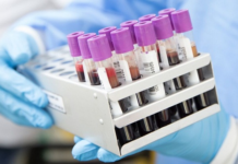 Em Gurupi, exame descarta o último caso suspeito de Monkeypox